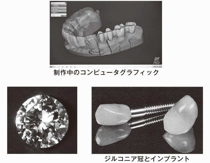 人工ダイヤモンド