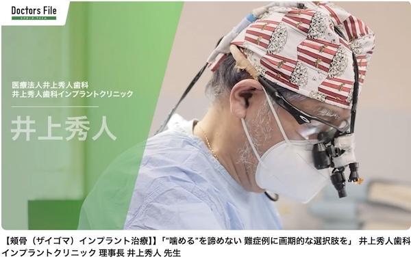 ザイゴマインプラントの説明動画をアップ