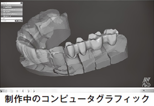 歯科技工士の技
